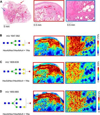 Applying imaging mass spectrometry to define the N-glycan profiles of co-localized virus and immune cell infiltrates in post-COVID-19 infected lung autopsy tissues